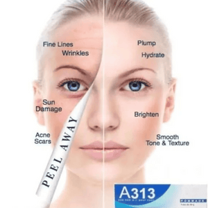 
                  
                    Load image into Gallery viewer, A313 Retinol Cream 50g
                  
                