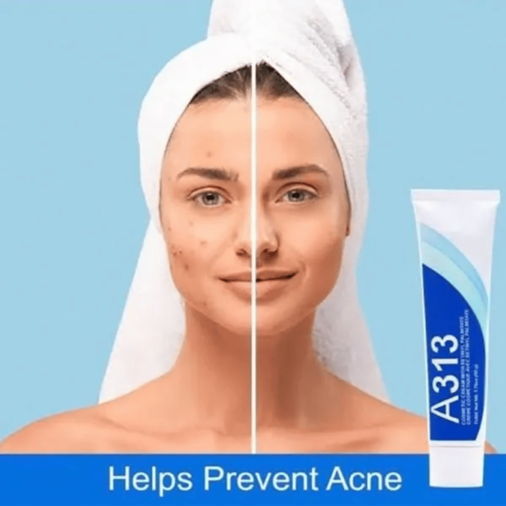 
                  
                    Load image into Gallery viewer, A313 Retinol Cream 50g
                  
                