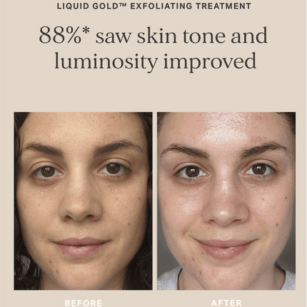 Alpha-H Liquid Gold with 5% Glycolic Acid 200ml