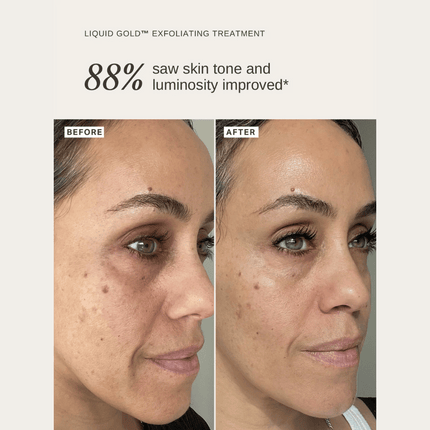 Alpha-H Liquid Gold 30ml