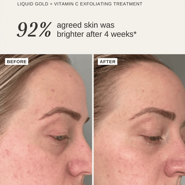 Alpha-H Liquid Gold + Vitamin C Trial Kit