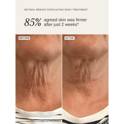 Alpha-H Retinol Reboot Exfoliating Body Treatment 120ml