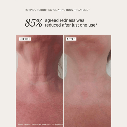 Alpha-H Retinol Reboot Exfoliating Body Treatment 120ml