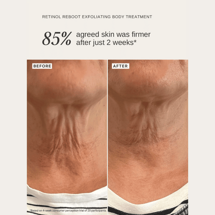 Alpha-H Retinol Reboot Exfoliating Body Treatment 120ml