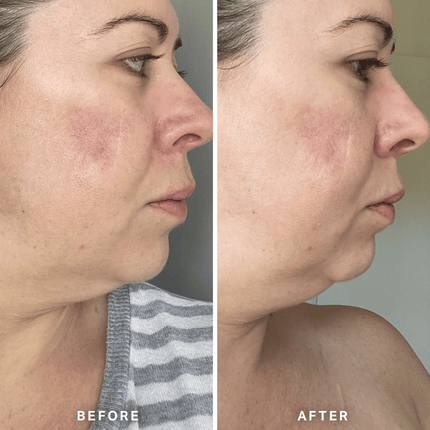 Alpha-H Vitamin A Serum 10ml