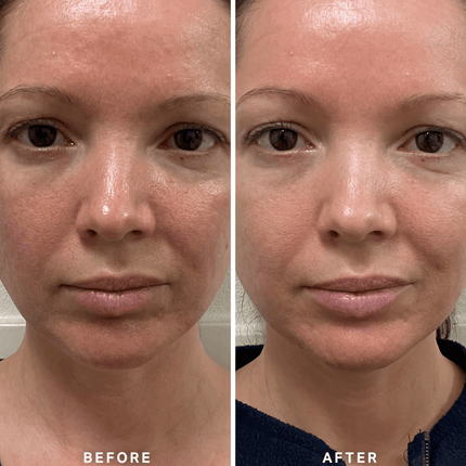 Alpha-H Vitamin B Serum 25ml