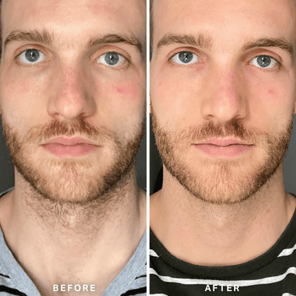 Alpha-H Vitamin B Serum with 5% Niacinamide 10ml