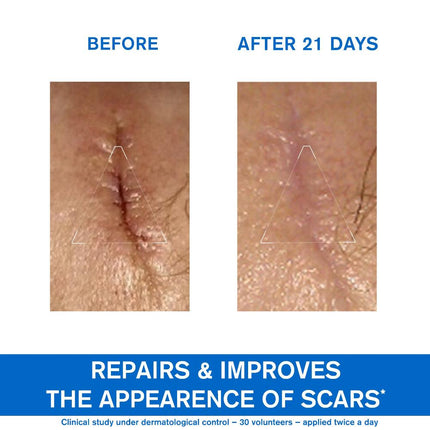 Uriage Bariederm Repairing Cica-Cream 100ml