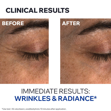 Uriage Age Absolu Eye Contour 15ml - product image 5