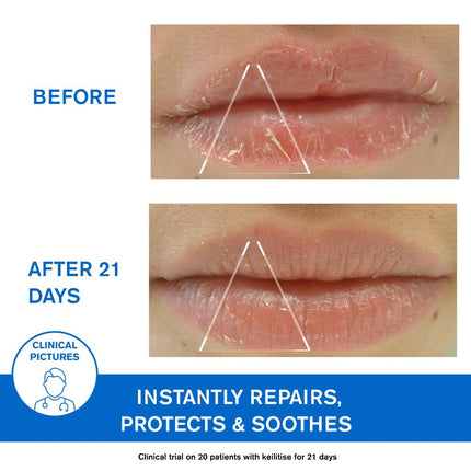 Uriage D.S. Regulating Emulsion, Irritation, Redness, Scales 40ml