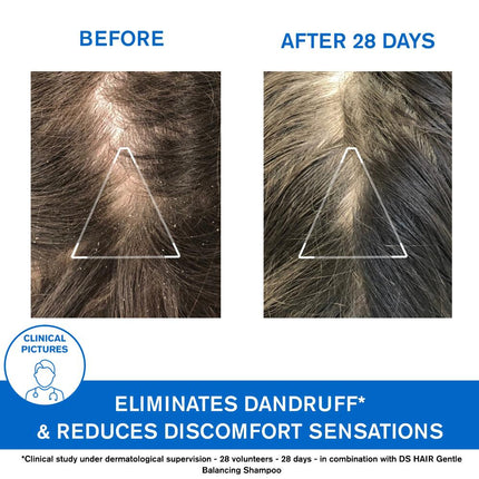 Uriage D.S. Hair Anti-Dandruff Treatment Shampoo 200ml