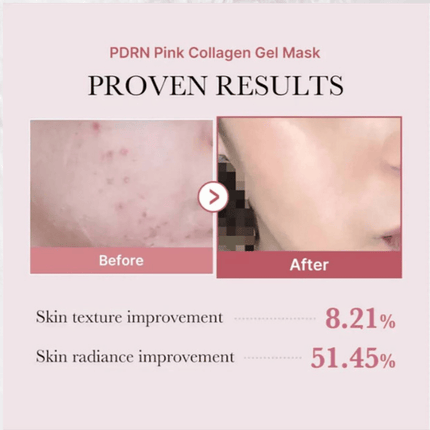 MEDICUBE PDRN Pink Collagen Gel Mask 28g