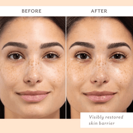 Patchology Skin Remedy Barrier-Boosting Sheet Mask - Single