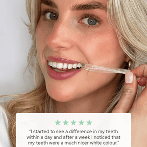 
                  
                    Load image into Gallery viewer, Spotlight Ultra Teeth Whitening Strips - 7 Day
                  
                