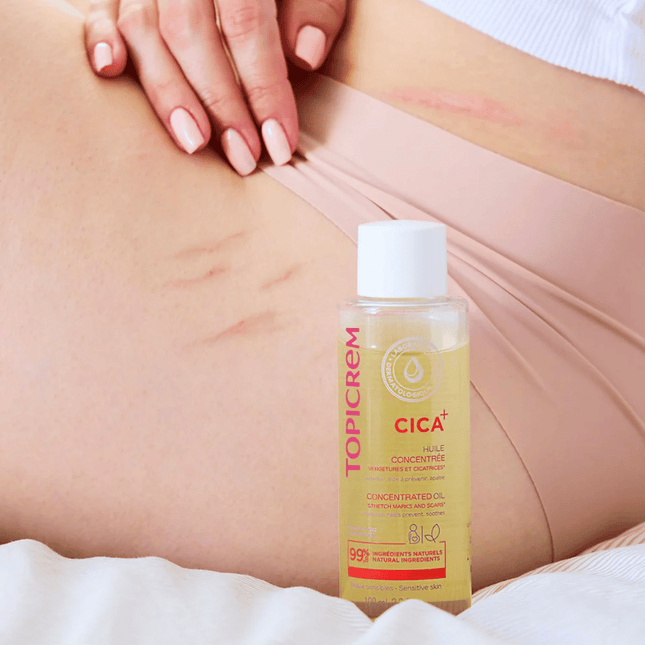 Topicrem Cica + Concentrated Oil For Stretch Marks And Scars 100ml